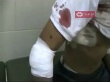 فري برس   حمص باباعمرو احد جرحى قوات  الاجرام الاسدي 10 9 2011