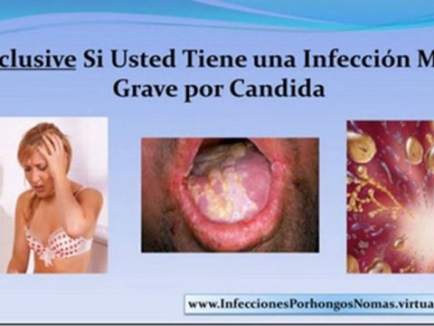 hongos genitales tratamiento - hongos vaginales tratamiento - tratamiento hongos genitales