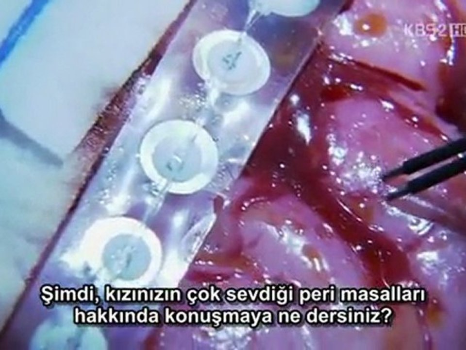 Brain 03-muxed-004