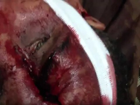 فري برس حمص الخالدية شهيد من آل عبد الحق برصاص قناصة 12 11 2011