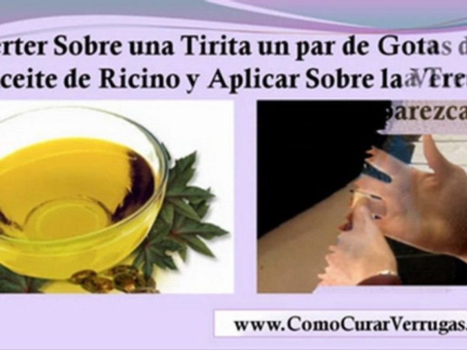 remedios caseros para las verrugas en el cuello