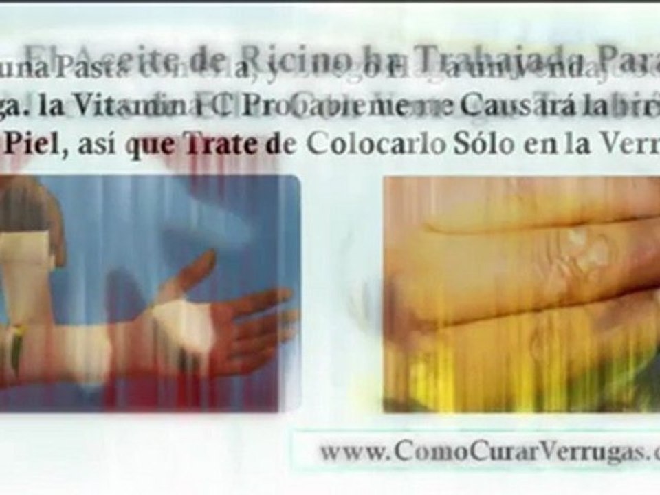 como eliminar verrugas en el cuello