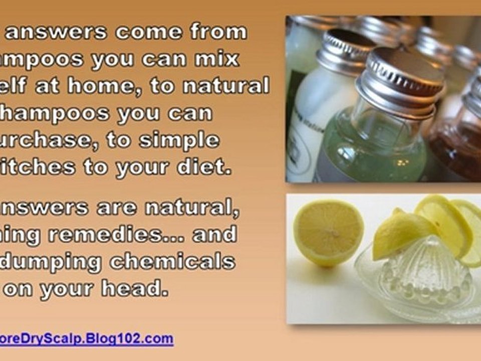 dry scalp remedies - home remedies for dry scalp - dry flaky scalp