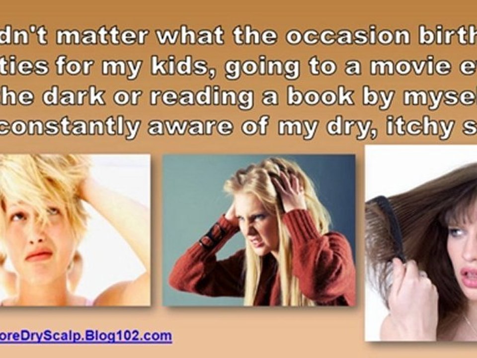 how to treat dry scalp - treatment for dry scalp - itchy dry scalp