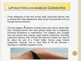 Liposuction Los Angeles - AMAZING RESULTS