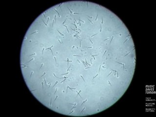 Sperm Visualizer - MUSIC SAVES TOMORROW