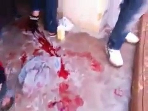 فري برس معضمية الشام جرحى اثناء تشييع الشهيد خالد حسنين 28 1 2012