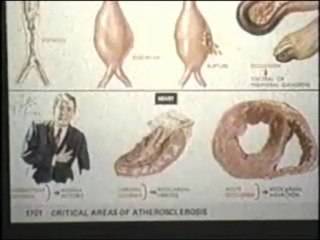Food That Kills - Full Documentary