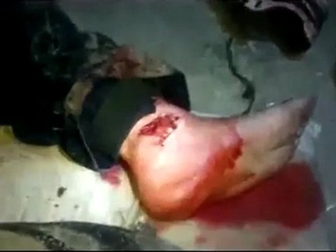 فري برس ريف دمشق عربين صور لاصابات عناصر الجيش الحر 28 1 2012