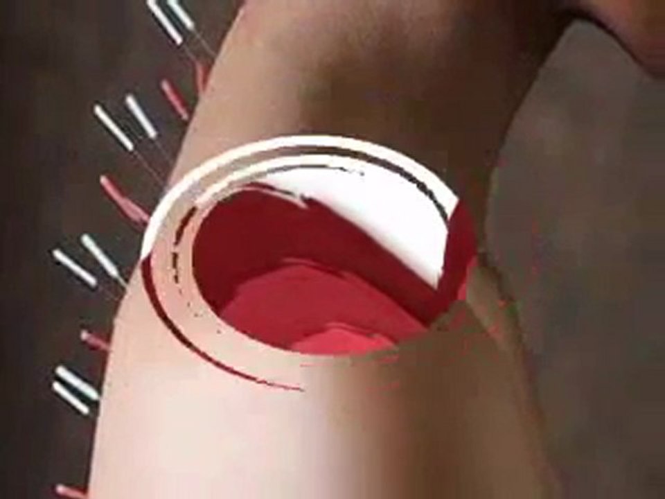Acupuncture Roanoke Virginia