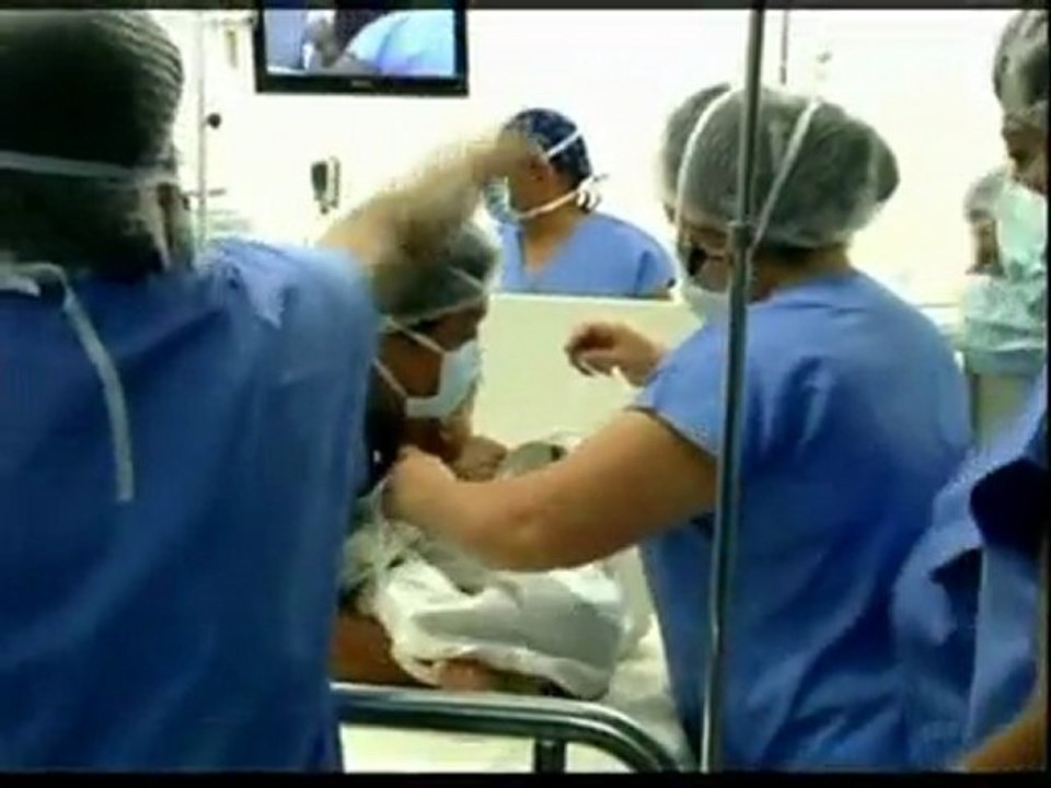 Boy has 'parasitic twin' living inside his stomach