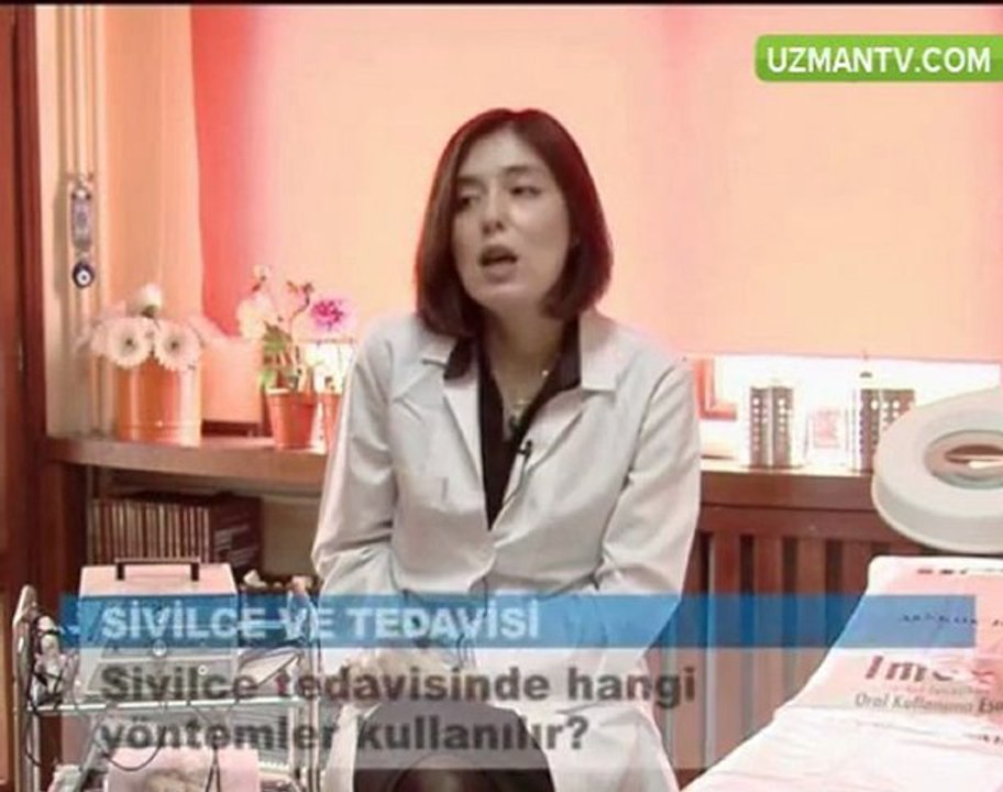sivilcenin tedavisi