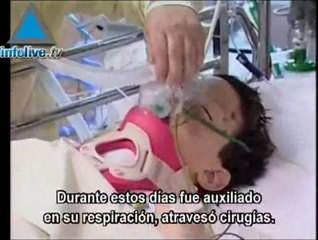 Niño amputado se recupera lentamente y con dificultad