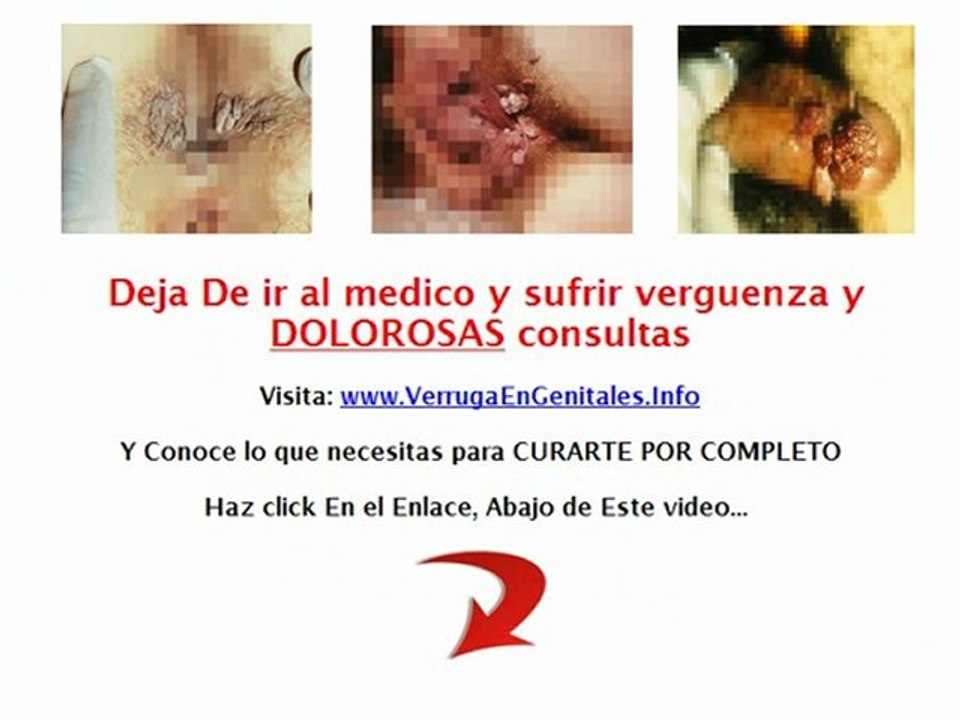tratamiento contra el papiloma humano