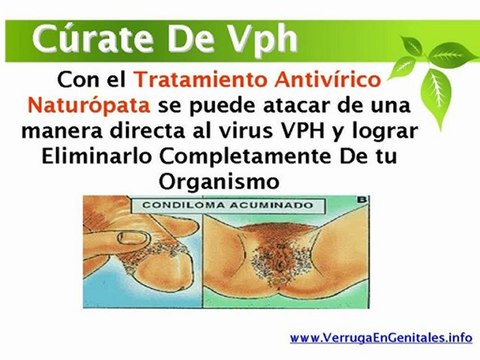 fotos de verrugas genitales en mujeres - como se quitan las verrugas genitales