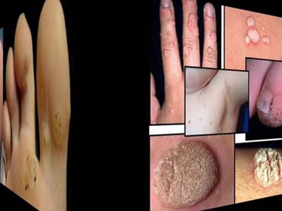 como eliminar manchas - eliminar las manchas en la cara - eliminar manchas cara