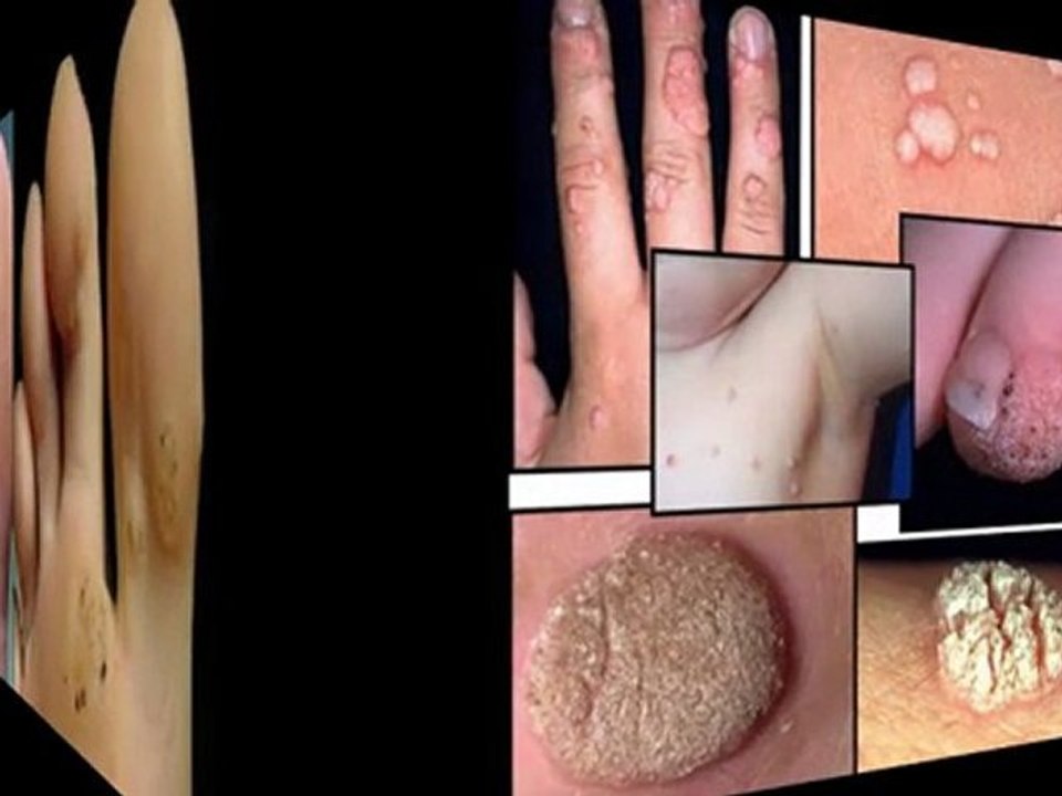 quitar manchas de la piel - para quitar manchas de la piel - como eliminar manchas de la cara