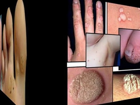 quitar manchas de la piel - para quitar manchas de la piel - como eliminar manchas de la cara