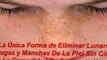 para quitar las manchas de la piel - quitar manchas de la piel - eliminar manchas en el rostro