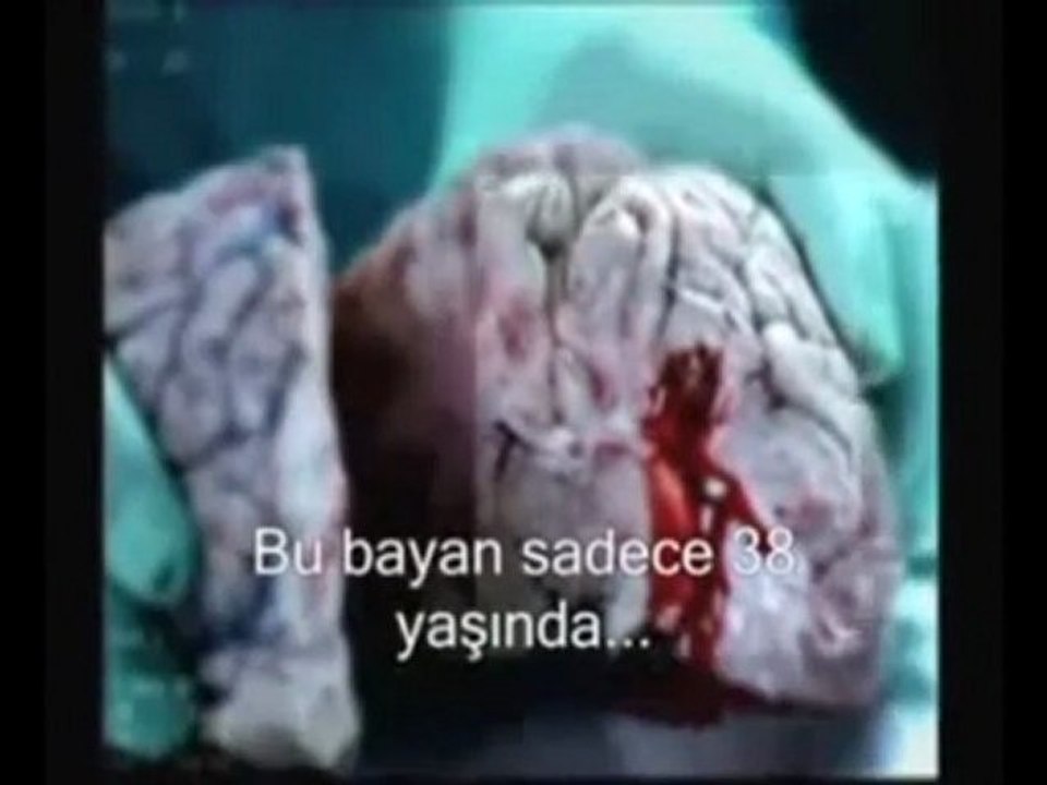 sigara video 1 ch