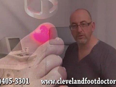 Laser Therapy Ingrown Toenails & Warts - Podiatrist in Twinsburg and Lakewood, OH