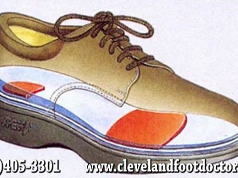 Diabetic Foot Care - Podiatrist in Twinsburg and North Olmsted, OH