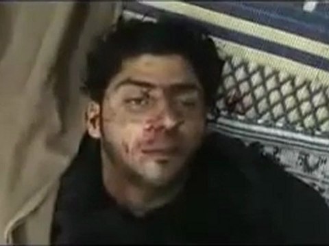 فري برس حمص الخالديه الجرحى جراء قصف عصابات الاسد +18؛؛؛مجزرة 4 2 2012 جــ2