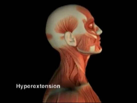 Orlando Car Accident Injury Center