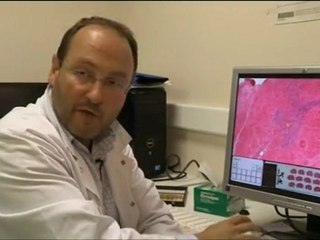 Aluminium - notre poison quotidien