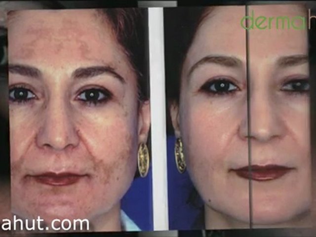 Buy Obagi Nu-Derm Blender - Obagi Hydroquinone Solution