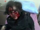 Syrie: des enfants sont victimes à Homs des bombardements