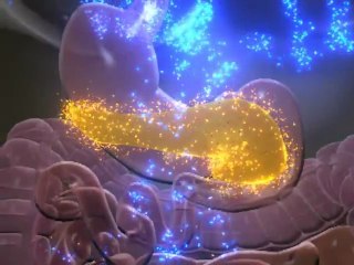 Diabetes Blurred Vision