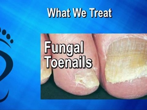 Podiatrist in Clinton Township, Sterling Heights and Macomb, MI - Stephanie Martin, DPM