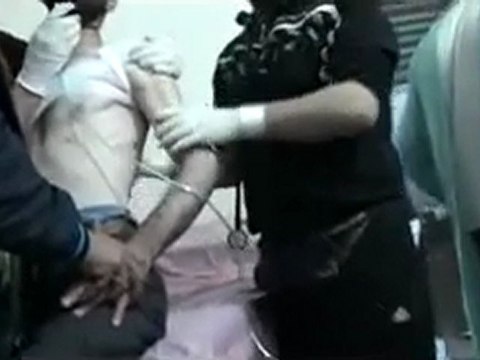 فري برس حمص باباعمرو أحد المصابين يختنق جراء إصابة الرئة من الظهر