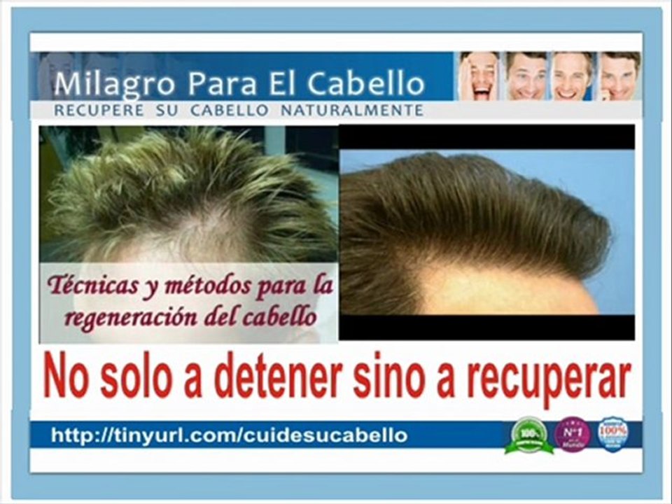 Como Evitar la Caida del Cabello, Frena la Calvicie