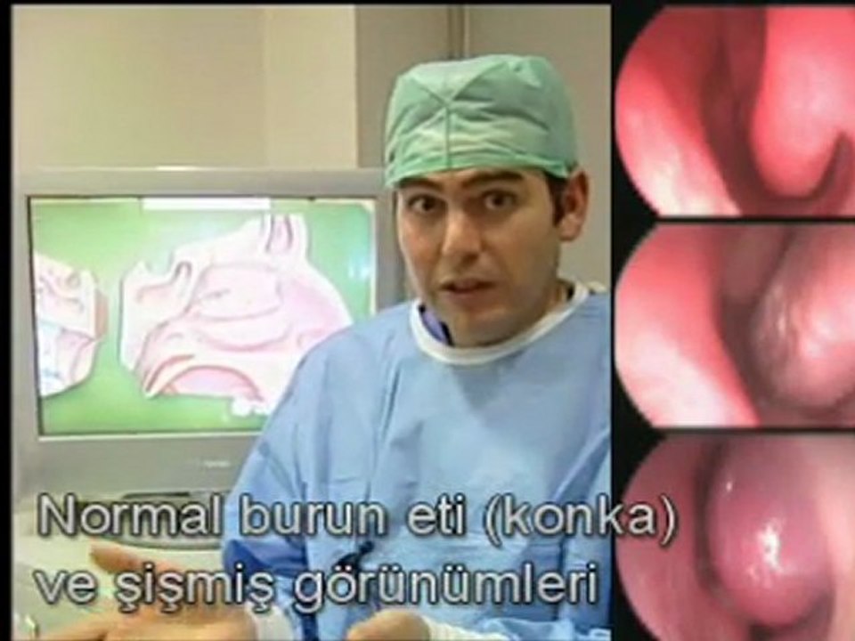 Her Deviasyon Ameliyatı Gerektirmiyor