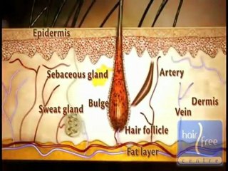 Hair Removal Secrets Explained: What is SPL?