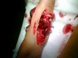 اصابات بشعة من الجيش الخائن النصيري لأطفال حماة الأبية 2012/214  18