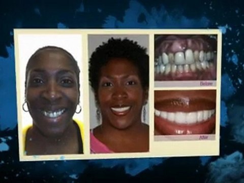 Dentist Philadelphia