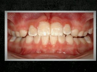 Westminster Orthodontist Jan2012