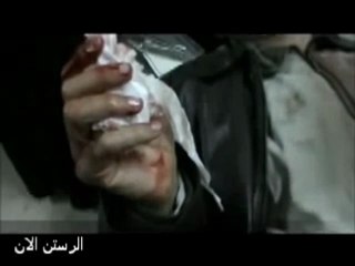 فري برس   حمص الرستن مصاب بسبب القصف المدفعي 15 2 2012