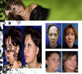 How To Find The Best Plastic Surgeon Beverly Hills?