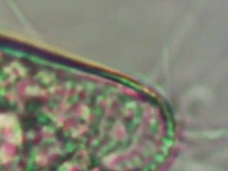 cyphoderia margaritacea schlumberger  サイフォデリア科