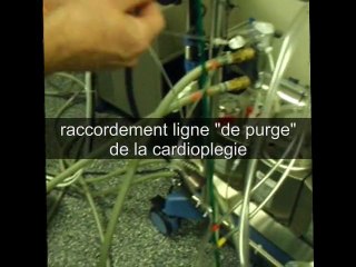 Montage d'une CEC RX25
