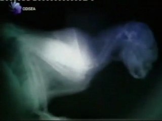 Rayos X: Cuerpos en movimiento