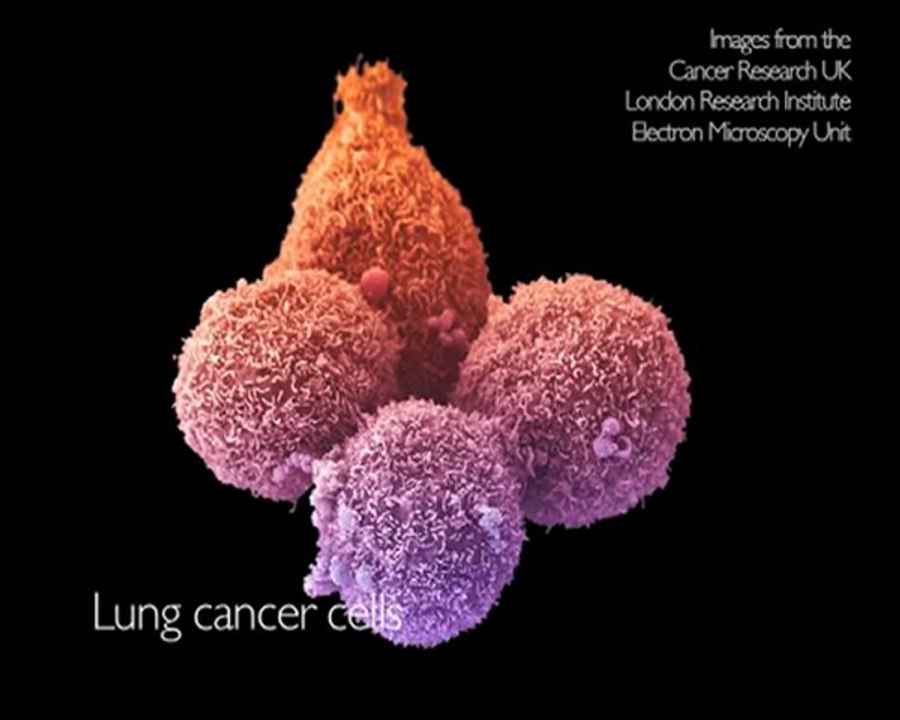 CRUK | Research and trials | Electron microscopy of cancer cells