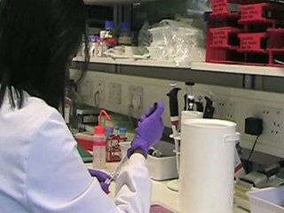 CRUK | Patient information | John Bridgewater talks about bileduct cancer