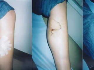 CRUK | SunSmart | New sunbed laws will save lives