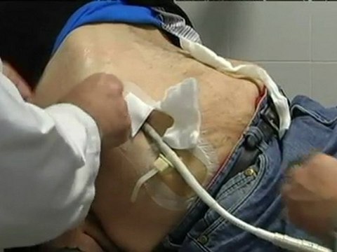 TV3 - L'Hospitalet de Llobregat - Viure amb un cor artificial