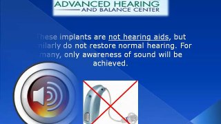 Cochlear Implant Evanston IL